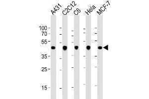 Image no. 6 for anti-Actin, beta (ACTB) antibody (ABIN658990)