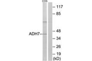 Image no. 1 for anti-Alcohol Dehydrogenase 7 (Class IV), mu Or sigma Polypeptide (ADH7) (AA 211-260) antibody (ABIN1534612)