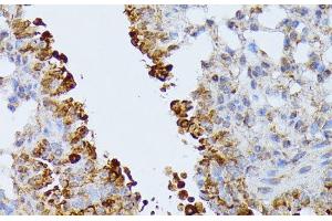 Immunohistochemistry of paraffin-embedded Mouse lung using SEPT4 Polyclonal Antibody at dilution of 1:100 (40x lens).