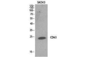 Image no. 2 for anti-CD63 (CD63) (Internal Region) antibody (ABIN3181065)