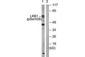 Western blot analysis of extracts from HeLa cells treated with PMA 125ng/ml 30', using LKB1 (Phospho-Ser428) Antibody.