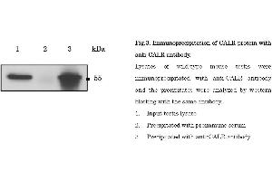 Image no. 3 for anti-Calreticulin (CALR) (C-Term) antibody (ABIN2451930)