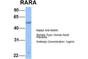 Image no. 2 for anti-Retinoic Acid Receptor, alpha (RARA) (N-Term) antibody (ABIN2778740)