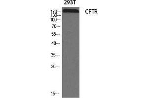 Image no. 2 for anti-Cystic Fibrosis Transmembrane Conductance Regulator (ATP-Binding Cassette Sub-Family C, Member 7) (CFTR) (Ser246) antibody (ABIN3183888)