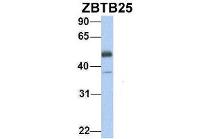 Image no. 2 for anti-Zinc Finger and BTB Domain Containing 25 (ZBTB25) (Middle Region) antibody (ABIN2780821)