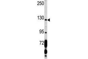 Western blot analysis of PDGFRA antibody and K562 lysate.