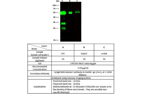 anti-Carboxypeptidase, Vitellogenic-Like (CPVL) (AA 1-476) antibody