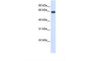 Image no. 1 for anti-Solute Carrier Family 39 (Zinc Transporter), Member 4 (SLC39A4) (N-Term) antibody (ABIN6738108)