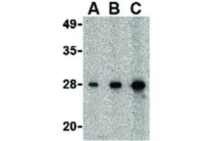 Image no. 2 for anti-Cell Death-Inducing DFFA-Like Effector B (CIDEB) (C-Term) antibody (ABIN6656668)