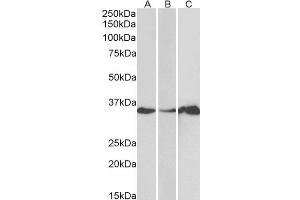 Image no. 1 for anti-LIM and SH3 Protein 1 (LASP1) (N-Term) antibody (ABIN184658)
