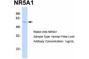 Image no. 2 for anti-Nuclear Receptor Subfamily 5, Group A, Member 1 (NR5A1) (Middle Region) antibody (ABIN2777447)