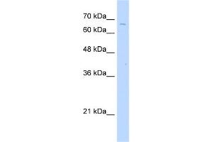 WB Suggested Anti-TKTL2 Antibody Titration:  2.