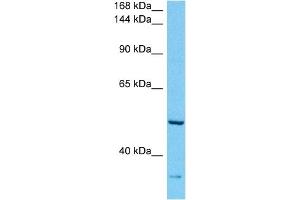 Image no. 1 for anti-ATP-Binding Cassette, Sub-Family A (ABC1), Member 10 (ABCA10) (C-Term) antibody (ABIN5516453)