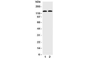 Image no. 2 for anti-Solute Carrier Family 12 (Potassium-Chloride Transporter) Member 6 (SLC12A6) (C-Term) antibody (ABIN3032670)