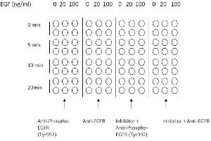 Epidermal Growth Factor Receptor (EGFR) ELISA Kit