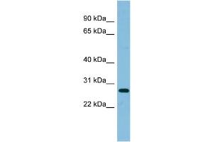 Image no. 1 for anti-Ribosomal Protein L10a (RPL10A) (Middle Region) antibody (ABIN2786867)