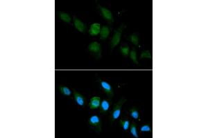 Image no. 7 for anti-Major Histocompatibility Complex, Class I, A (HLA-A) antibody (ABIN1873024)