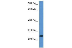 Image no. 1 for anti-Chromosome 1 Open Reading Frame 93 (C1orf93) (Middle Region) antibody (ABIN928668)