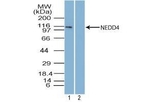Image no. 1 for anti-Neural Precursor Cell Expressed, Developmentally Down-Regulated 4, E3 Ubiquitin Protein Ligase (NEDD4) (AA 950-1000) antibody (ABIN960275)