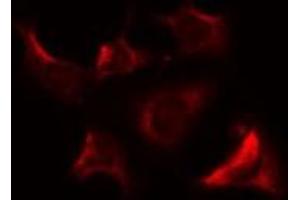 anti-Mitochondrial Ribosomal Protein S9 (MRPS9) (Internal Region) antibody