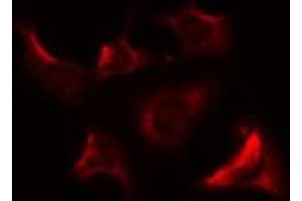 anti-Mitochondrial Ribosomal Protein S9 (MRPS9) (Internal Region) antibody