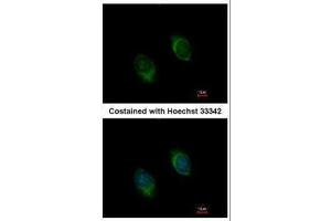 ICC/IF Image Immunofluorescence analysis of methanol-fixed HeLa, using BMP4, antibody at 1:100 dilution.