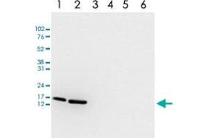 Image no. 1 for anti-Histone Cluster 1, H3a (HIST1H3A) (acLys18) antibody (ABIN5773851)