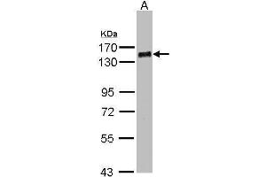 Image no. 1 for anti-PHD Finger Protein 20 (PHF20) (N-Term) antibody (ABIN2854431)