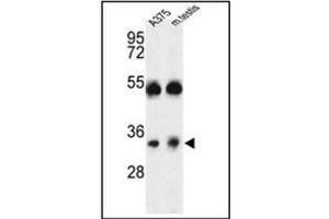 Image no. 2 for anti-ORAI Calcium Release-Activated Calcium Modulator 1 (ORAI1) (AA 152-181), (Middle Region) antibody (ABIN953931)
