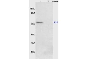 Image no. 2 for anti-Peroxisome Proliferator-Activated Receptor gamma (PPARG) (pSer273) antibody (ABIN1387919)