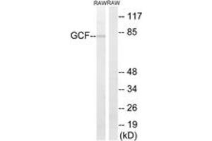 Image no. 1 for anti-PAX3 and PAX7 Binding Protein 1 (PAXBP1) (AA 141-190) antibody (ABIN2890341)