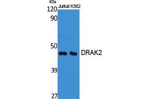 Image no. 2 for anti-serine/threonine Kinase 17b (STK17B) (Internal Region) antibody (ABIN3184357)