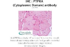 Image no. 1 for anti-Protein tyrosine Phosphatase, Receptor Type, A (PTPRA) (Cytoplasmic Domain) antibody (ABIN1738602)