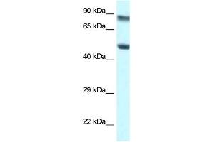 Western Blot showing PUS1 antibody used at a concentration of 1 ug/ml against Jurkat Cell Lysate
