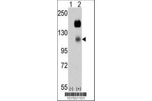 Image no. 1 for anti-PTK7 Protein tyrosine Kinase 7 (PTK7) (AA 21-52), (N-Term) antibody (ABIN392230)