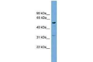 Image no. 2 for anti-Radical S-Adenosyl Methionine Domain Containing 1 (RSAD1) (Middle Region) antibody (ABIN2787121)