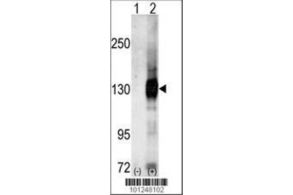 anti-Calcium/calmodulin-Dependent serine Protein Kinase (MAGUK Family) (CASK) (AA 564-596), (C-Term) antibody