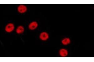 Image no. 1 for anti-General Transcription Factor IIIC, Polypeptide 3, 102kDa (GTF3C3) antibody (ABIN6265528)
