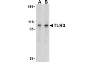 Image no. 3 for anti-Toll-Like Receptor 3 (TLR3) (C-Term) antibody (ABIN500948)