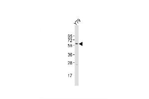 Image no. 4 for anti-Keratin 12 (KRT12) (AA 442-471), (C-Term) antibody (ABIN656663)