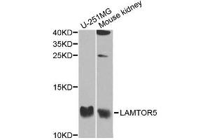Image no. 1 for anti-Hepatitis B Virus X-Interacting Protein (HBXIP) antibody (ABIN6143085)