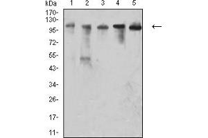 VCAM1 anticorps  (AA 24-168)