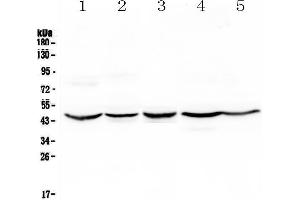 Image no. 1 for anti-Hydroxymethylbilane Synthase (HMBS) (AA 6-361) antibody (ABIN5692868)