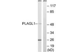 Image no. 1 for anti-Pleiomorphic Adenoma Gene-Like 1 (PLAGL1) (AA 311-360) antibody (ABIN1535506)