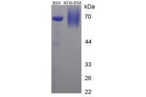 Image no. 3 for Cross Linked N-Telopeptide of Type I Collagen (NTX-I) peptide (BSA) (ABIN5665958)