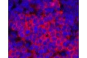 Immunofluorescence analysis of Rat spleen tissue using Cleaved-PARP1 (D214) Polyclonal Antibody at dilution of 1:200.