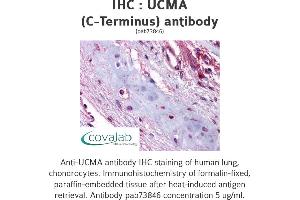 Image no. 1 for anti-Upper Zone of Growth Plate and Cartilage Matrix Associated (UCMA) (C-Term) antibody (ABIN1740574)