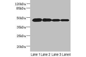 Western blot All lanes: PCOLCE2 antibody at 8 μg/mL Lane 1: MCF-7 whole cell lysate Lane 2: A549 whole cell lysate Lane 3: HCT116 whole cell lysate Lane 4: Human high value serum Secondary Goat polyclonal to rabbit IgG at 1/10000 dilution Predicted band size: 46 kDa Observed band size: 46 kDa