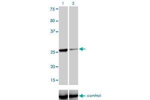 Image no. 9 for anti-TGFB-Induced Factor Homeobox 2 (TGIF2) (AA 131-236) antibody (ABIN566207)