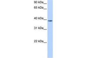 NUDT13 anticorps  (N-Term)